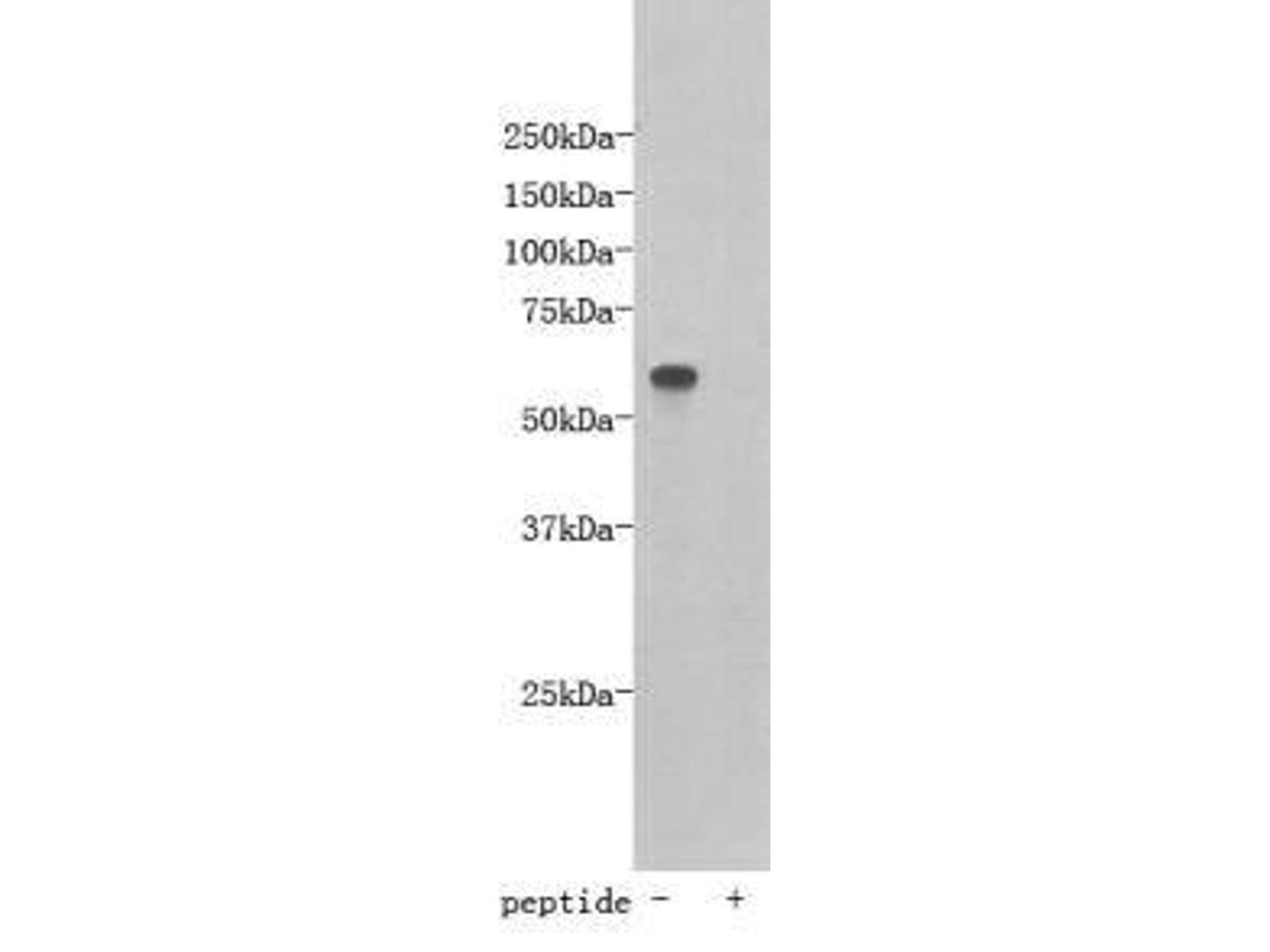Western blot analysis on D3 using anti- TMEM132E polyclonal antibody.