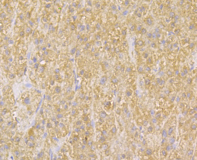 Immunohistochemical analysis of paraffin-embedded human liver tissue using anti-TMEM2 antibody. Counter stained with hematoxylin.