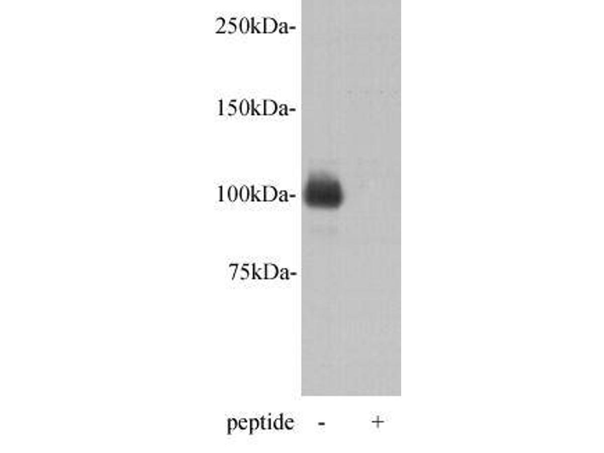 Western blot analysis on D3 using anti- PGBD5 polyclonal antibody.