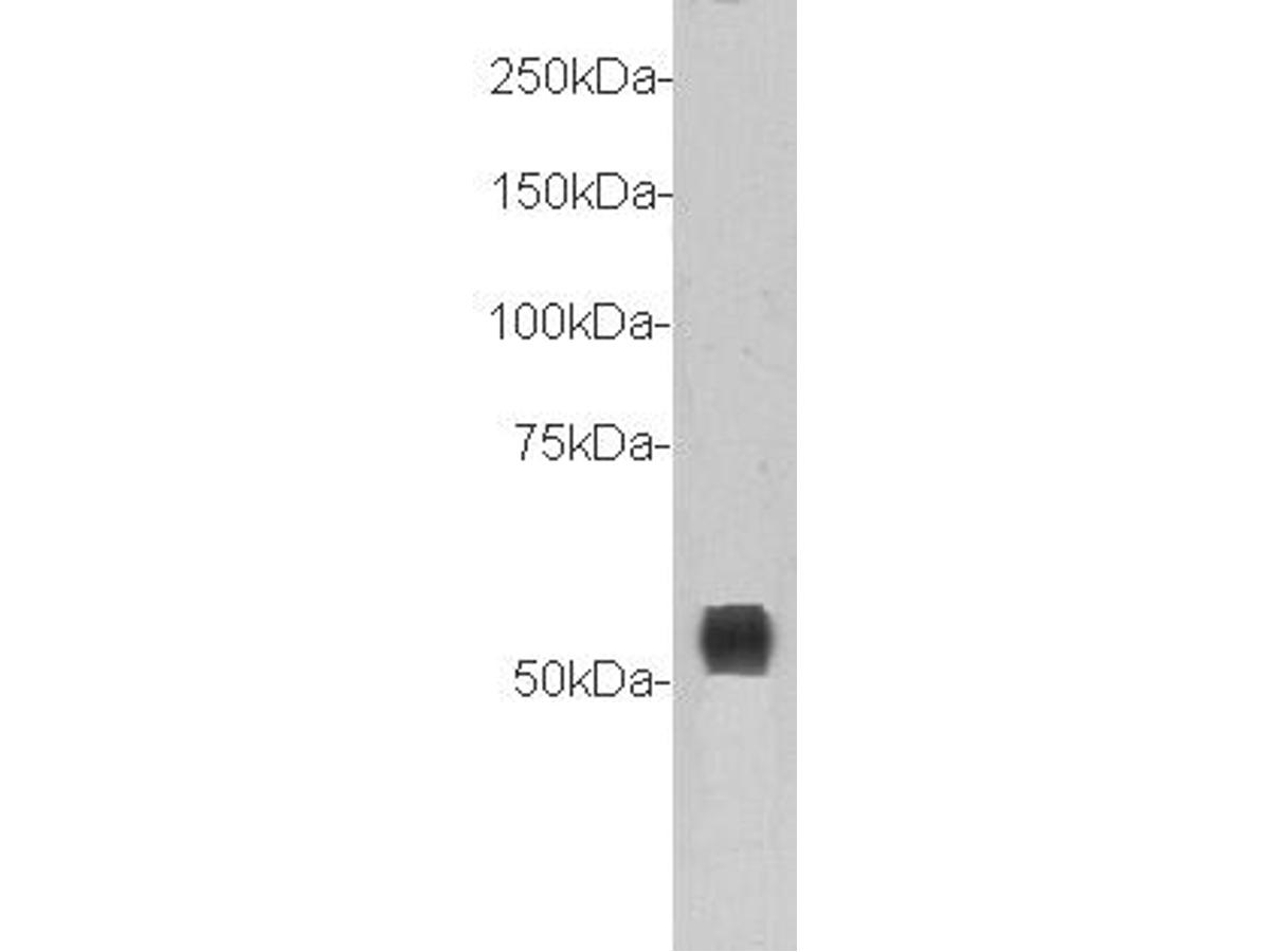 Western blot analysis of Transmembrane protein 132A on different lysates with Rabbit anti-Transmembrane protein 132A antibody (0903-8) at 1/500 dilution.<br />
<br />
Lane 1: MCF-7 cell lysate<br />
Lane 2: Mouse brain tissue lysate (20 µg/Lane)<br />
<br />
Lysates/proteins at 10 µg/Lane.<br />
<br />
Predicted band size: 110/44/55 kDa<br />
Observed band size: 55 kDa<br />
<br />
Exposure time: 2 minutes;<br />
<br />
10% SDS-PAGE gel.<br />
<br />
Proteins were transferred to a PVDF membrane and blocked with 5% NFDM/TBST for 1 hour at room temperature. The primary antibody (0903-8) at 1/500 dilution was used in 5% NFDM/TBST at room temperature for 2 hours. Goat Anti-Rabbit IgG - HRP Secondary Antibody (HA1001) at 1:300,000 dilution was used for 1 hour at room temperature.