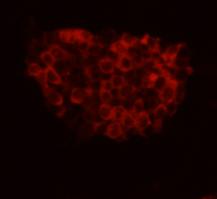 ICC image of FAT4 antibody stained D3 (Murine Embryonic Stem Cell Line).The secondary antibody (red) was goat anti-rabbit IgG (H+L) alexa555 conjugated.