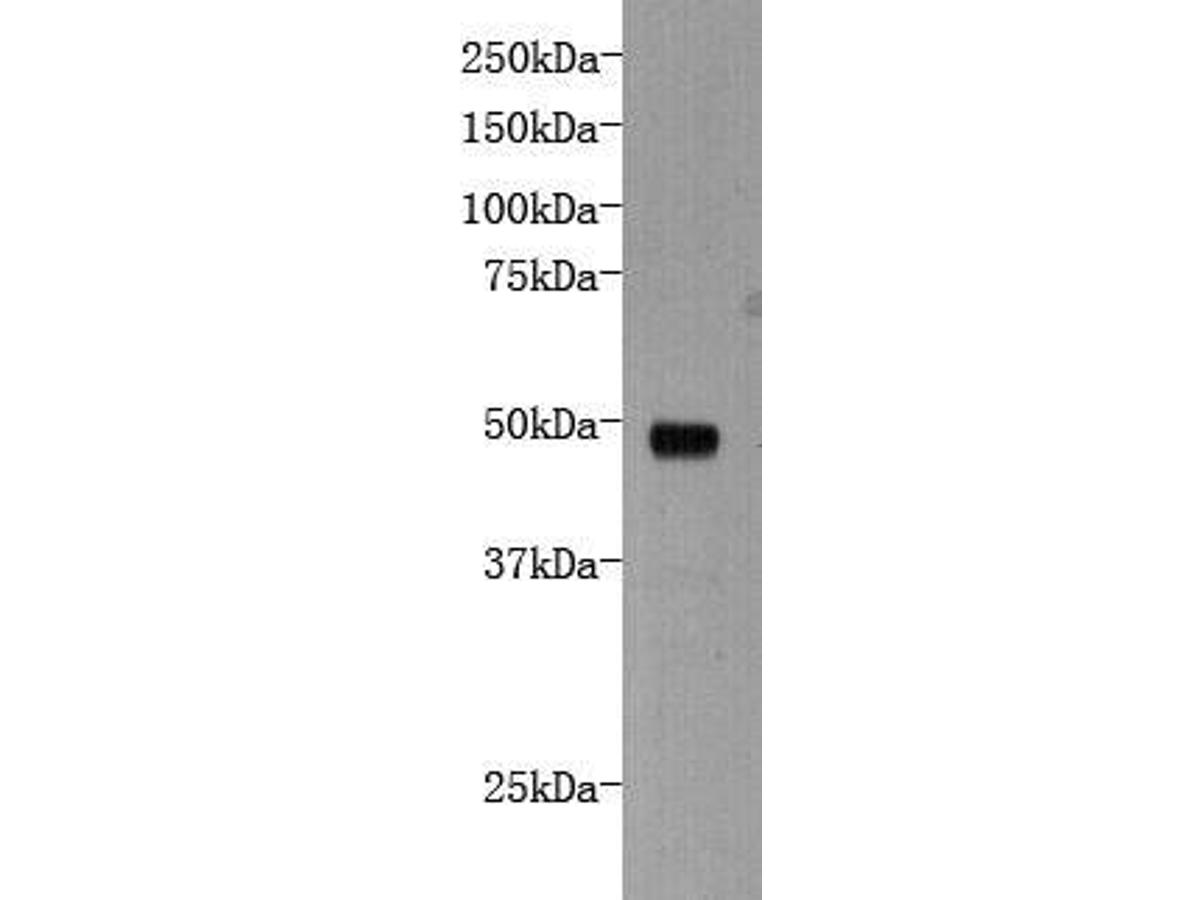 Western blot analysis on the recombinant protein of protocadherin-16 using anti- protocadherin-16 polyclonal antibody.