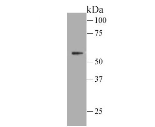 Western blot analysis of Frizzled-5 on human ES cell lysate. Proteins were transferred to a PVDF membrane and blocked with 5% BSA in PBS for 1 hour at room temperature. The primary antibody was used at a 1:500 dilution in 5% BSA at room temperature for 2 hours. Goat Anti-Rabbit IgG - HRP Secondary Antibody (HA1001) at 1:5,000 dilution was used for 1 hour at room temperature.