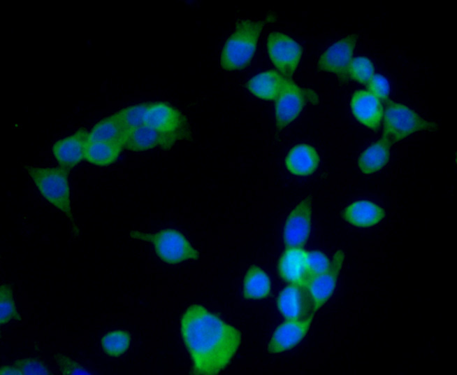 ICC staining VANGL1 in LOVO cells (green). The nuclear counter stain is DAPI (blue). Cells were fixed in paraformaldehyde, permeabilised with 0.25% Triton X100/PBS.
