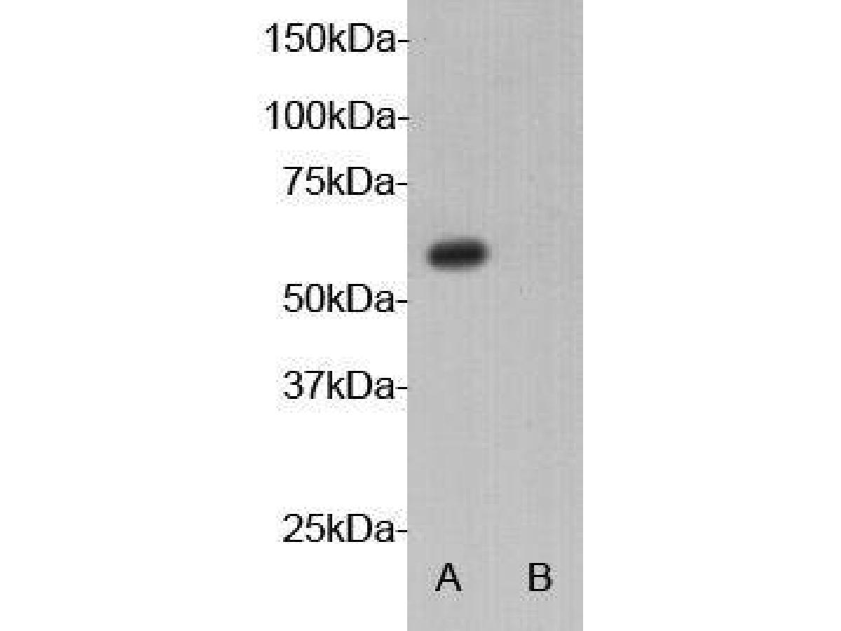 Western blot analysis on 293 cell (A) transfected and (B) none transfected   with AIRE gene using anti-AIRE polyclonal antibody.