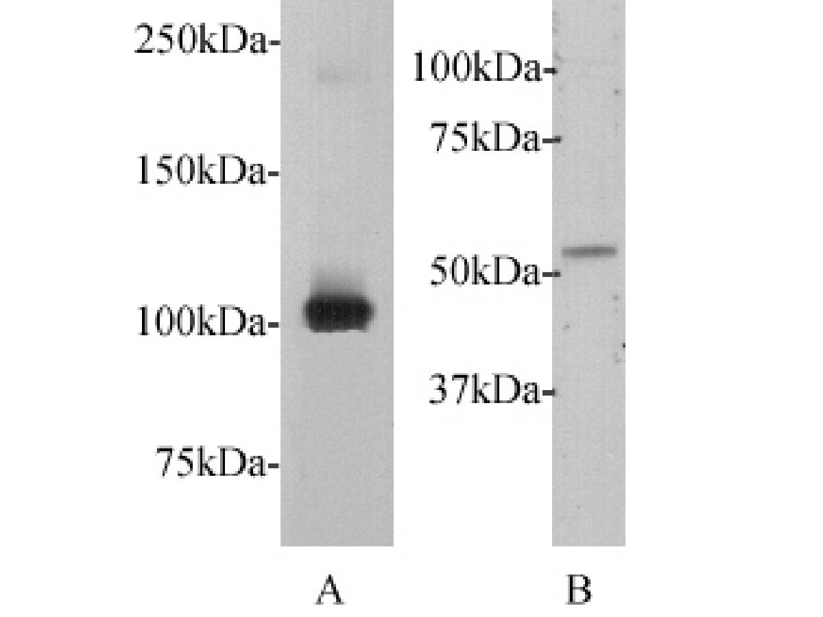 Western blot analysis on myc-tagged recombinant protein (A) and A549 cell lysates (B).