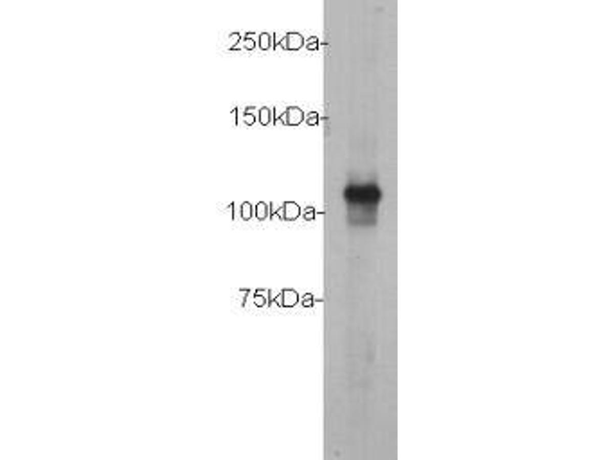 Western blot analysis on myc-tagged recombinant protein using c-myc antibody HRP conjugated.