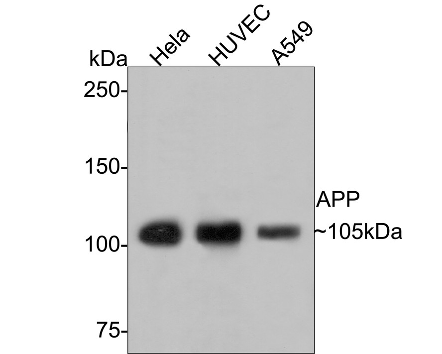 Western blot analysis of Amyloid Beta A4 Precursor (APP) on different lysates with Rabbit anti-Amyloid Beta A4 Precursor (APP) antibody (1007-5) at 1/1,000 dilution.<br />
<br />
Lane 1: Hela cell lysate<br />
Lane 2: HUVEC cell lysate<br />
Lane 3: A549 cell lysate<br />
<br />
Lysates/proteins at 10 µg/Lane.<br />
<br />
Predicted band size: 87 kDa<br />
Observed band size: 105 kDa<br />
<br />
Exposure time: 2 minutes;<br />
<br />
6% SDS-PAGE gel.<br />
<br />
Proteins were transferred to a PVDF membrane and blocked with 5% NFDM/TBST for 1 hour at room temperature. The primary antibody (1007-5) at 1/1,000 dilution was used in 5% NFDM/TBST at room temperature for 2 hours. Goat Anti-Rabbit IgG - HRP Secondary Antibody (HA1001) at 1:300,000 dilution was used for 1 hour at room temperature.