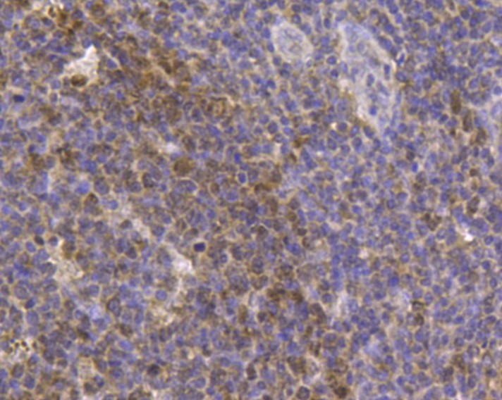 Immunohistochemical analysis of paraffin-embedded human tonsil tissue using anti-CD80 antibody. Counter stained with hematoxylin.