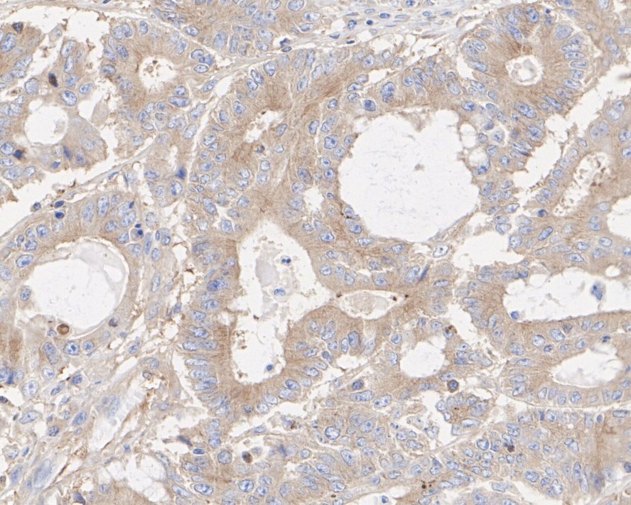 Immunohistochemical analysis of paraffin-embedded mouse brain tissue using anti-β-tubulin antibody. Counter stained with hematoxylin.