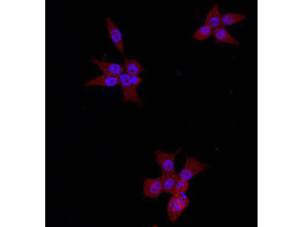 ICC staining Beta-Catenin in NCCIT cells (red). The nuclear counter stain is DAPI (blue). Cells were fixed in paraformaldehyde, permeabilised with 0.25% Triton X100/PBS.