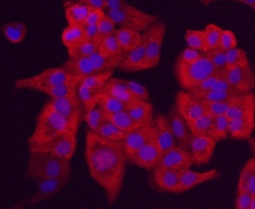ICC staining Chromogranin A(red) in Hela cells. The nuclear counter stain is DAPI(blue). Cells were fixed in paraformaldehyde, permeabilised with 0.25% Triton X100/PBS.