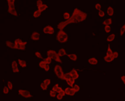 ICC staining Chromogranin A(red) in PANC-1 cells. Cells were fixed in paraformaldehyde, permeabilised with 0.25% Triton X100/PBS.