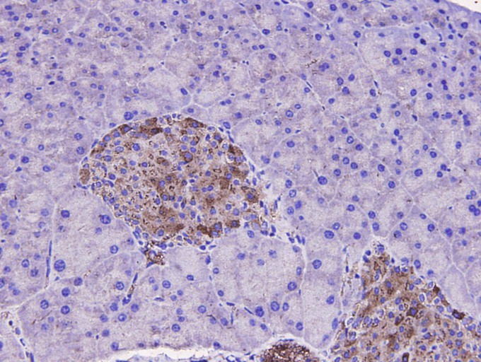 Immunohistochemical analysis of paraffin-embedded mouse prostate tissue using anti- SQSTM1 antibody. Counter stained with hematoxylin.