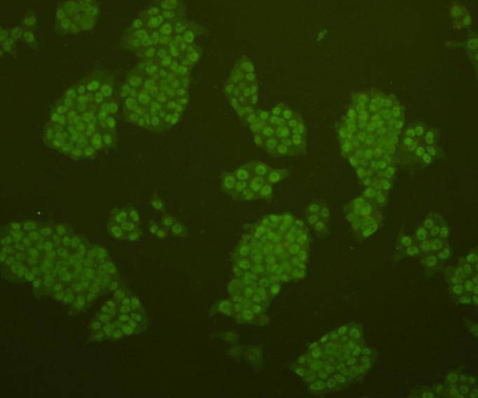 ICC staining of OCT-4 in NCCIT cells (green).  Cells were fixed in paraformaldehyde, permeabilised with 0.25% Triton X100/PBS.