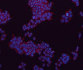 ICC staining GAPDH in F9 cells (red). The nuclear counter stain is DAPI (blue). Cells were fixed in paraformaldehyde, permeabilised with 0.25% Triton X100/PBS.