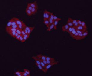 ICC staining GAPDH in Hela cells (red). The nuclear counter stain is DAPI (blue). Cells were fixed in paraformaldehyde, permeabilised with 0.25% Triton X100/PBS.