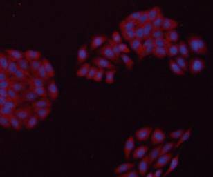 ICC staining GAPDH in HepG2 cells (red). The nuclear counter stain is DAPI (blue). Cells were fixed in paraformaldehyde, permeabilised with 0.25% Triton X100/PBS.