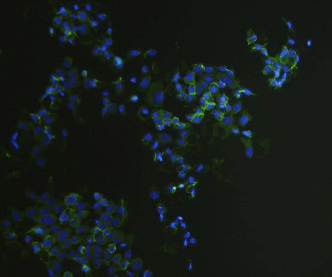 ICC staining EpCAM in A431 cells (green). The nuclear counter stain is DAPI (blue). Cells were fixed in paraformaldehyde, permeabilised with 0.25% Triton X100/PBS.