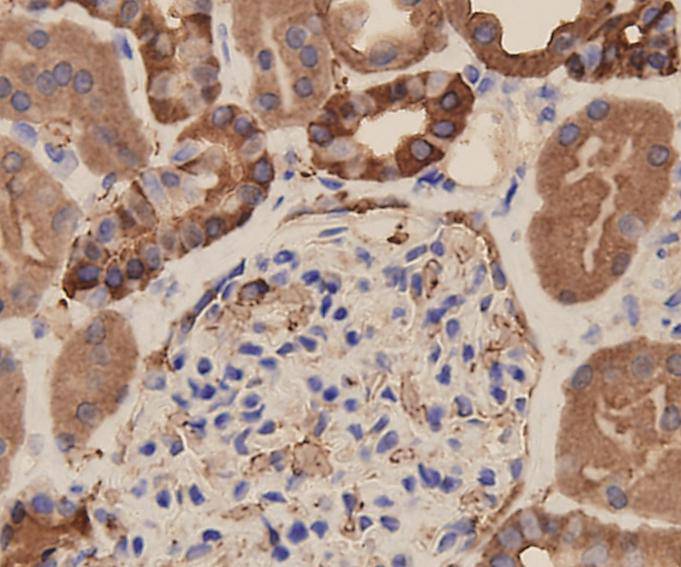 Immunohistochemical analysis of paraffin-embedded human kidney tissue using EpCAM antibody. Counter stained with hematoxylin.