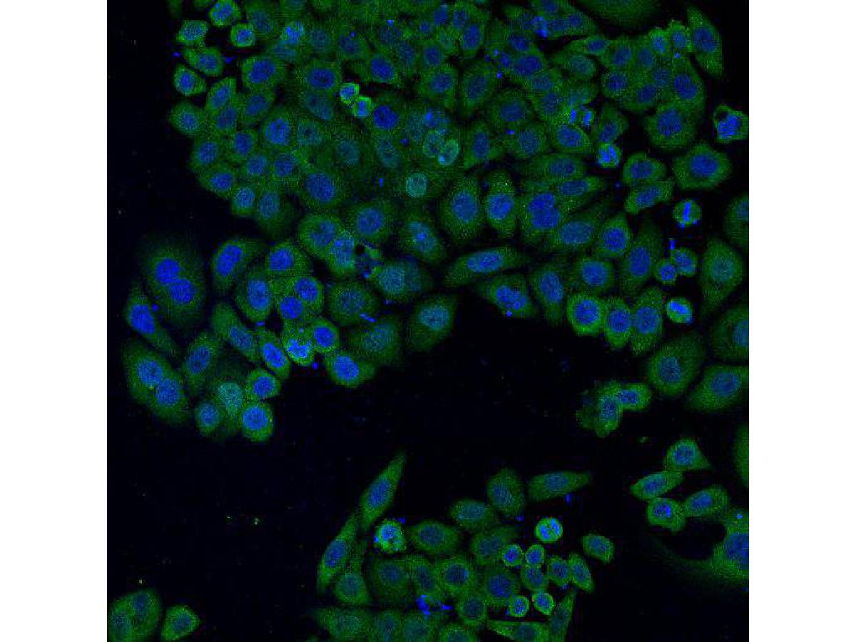 ICC staining of BAX in HepG2 cells (green). Formalin fixed cells were permeabilized with 0.1% Triton X-100 in TBS for 10 minutes at room temperature and blocked with 10% negative goat serum for 15 minutes at room temperature. Cells were probed with the primary antibody (EM1203, 1/50) for 1 hour at room temperature, washed with PBS. Alexa Fluor®488 conjugate-Goat anti-Mouse IgG was used as the secondary antibody at 1/1,000 dilution. The nuclear counter stain is DAPI (blue).