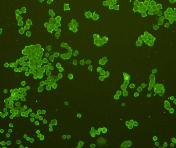 ICC staining of GFAP in N2A cells (green). Formalin fixed cells were permeabilized with 0.1% Triton X-100 in TBS for 10 minutes at room temperature and blocked with 1% Blocker BSA for 15 minutes at room temperature. Cells were probed with the primary antibody (EM140707, 1/50) for 1 hour at room temperature, washed with PBS. Alexa Fluor®488 Goat anti-Rabbit IgG was used as the secondary antibody at 1/1,000 dilution. The nuclear counter stain is DAPI (blue).