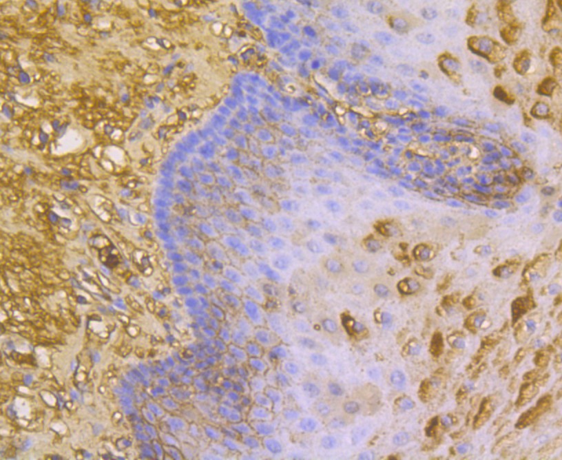 Immunohistochemical analysis of paraffin-embedded human esophagus tissue using anti-ORM1 antibody. Counter stained with hematoxylin.