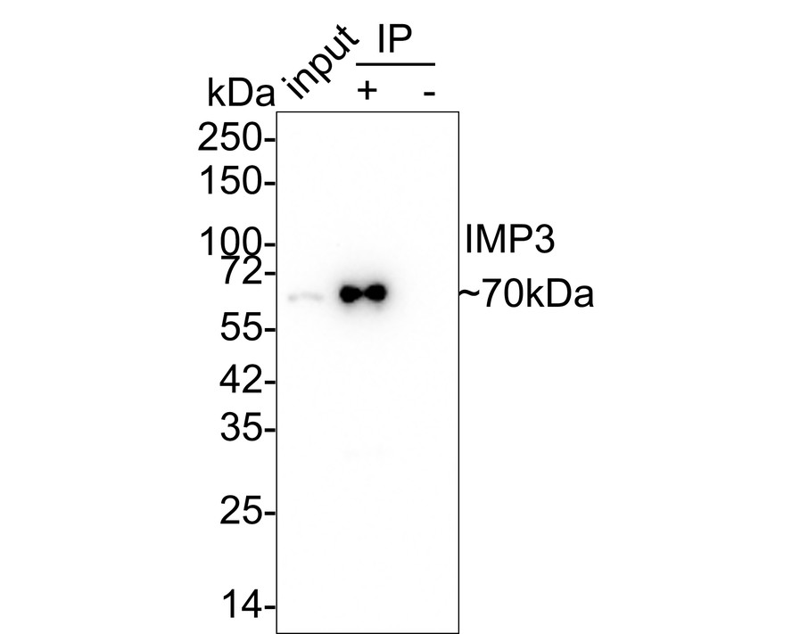 Western blot analysis of IMP-3 on 293T cell lysates with Mouse anti-IMP-3 antibody (EM1701-15) at 1/10,000 dilution.<br />
<br />
Lysates/proteins at 10 µg/Lane.<br />
<br />
Predicted band size: 64 kDa<br />
Observed band size: 64 kDa<br />
<br />
Exposure time: 1 minute;<br />
<br />
10% SDS-PAGE gel.<br />
<br />
Proteins were transferred to a PVDF membrane and blocked with 5% NFDM/TBST for 1 hour at room temperature. The primary antibody (EM1701-15) at 1/10,000 dilution was used in 5% NFDM/TBST at room temperature for 2 hours. Goat Anti-Mouse IgG - HRP Secondary Antibody (HA1006) at 1:100,000 dilution was used for 1 hour at room temperature.