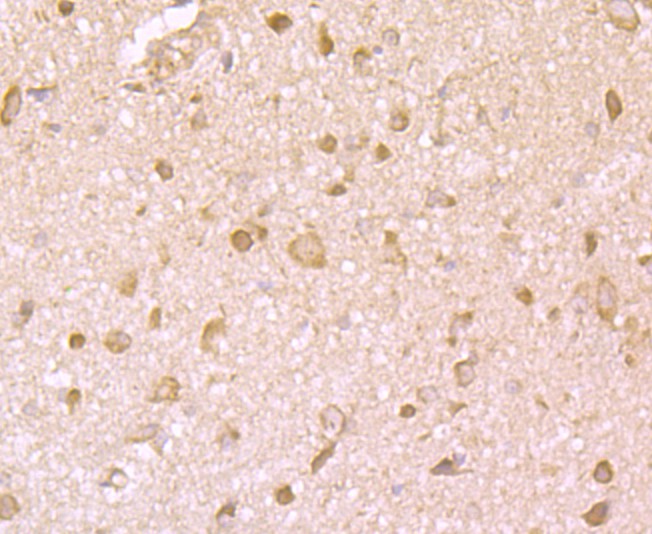 Immunohistochemical analysis of paraffin-embedded rat brain tissue using anti-IMP3 antibody. Counter stained with hematoxylin.