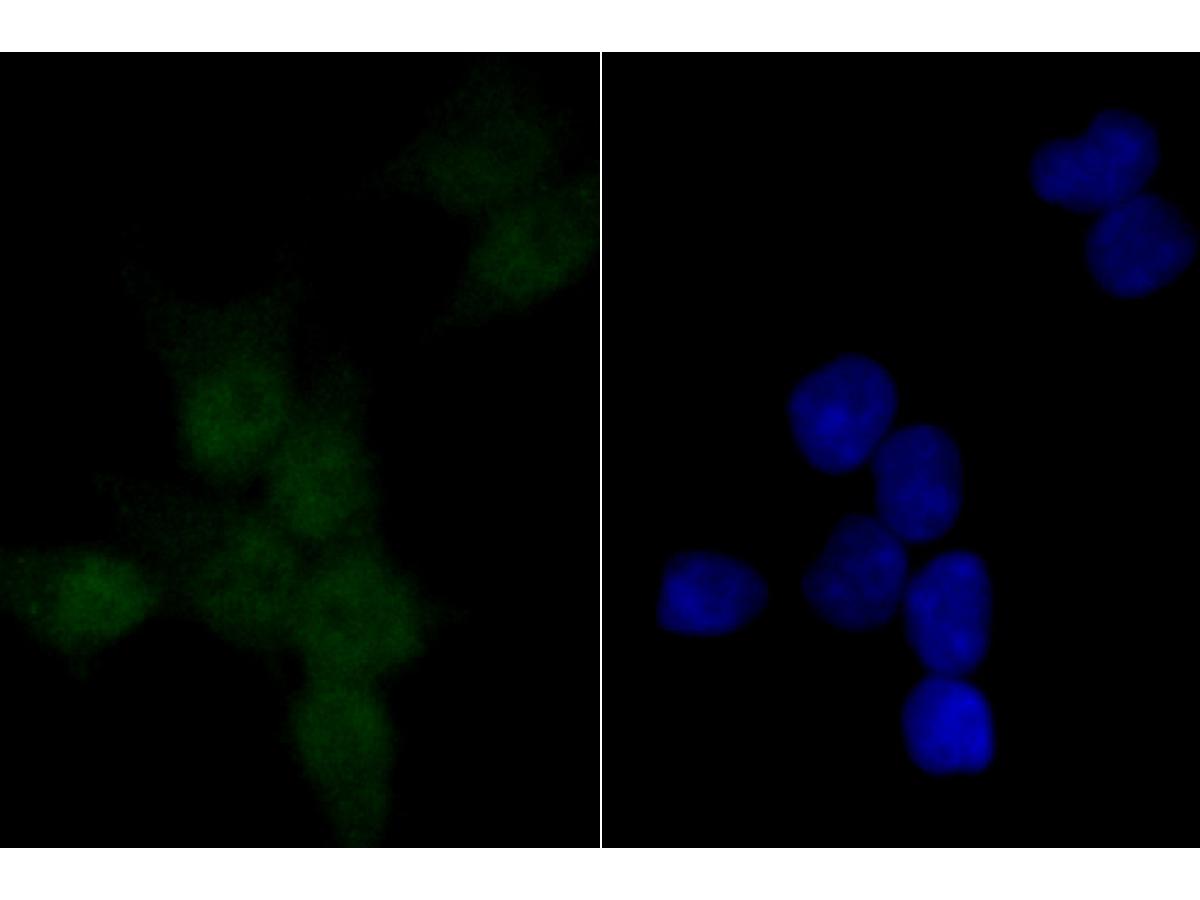 ICC staining PARP1 (green) in 293T cells. The nuclear counter stain is DAPI (blue). Cells were fixed in paraformaldehyde, permeabilised with 0.25% Triton X100/PBS.