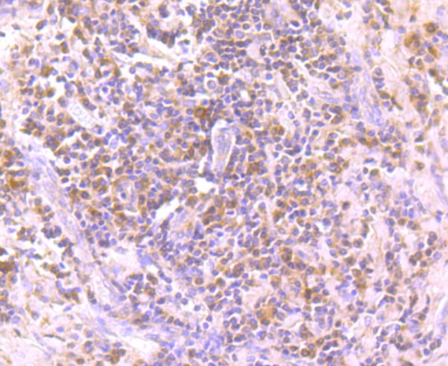 Immunohistochemical analysis of paraffin-embedded human tonsil tissue using anti- PARP1 antibody. Counter stained with hematoxylin.