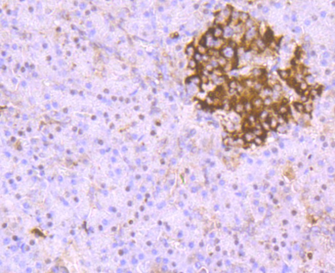 Immunohistochemical analysis of paraffin-embedded human pancreas tissue using anti- PARP1 antibody. Counter stained with hematoxylin.