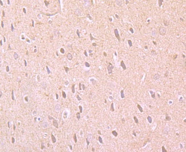 Immunohistochemical analysis of paraffin-embedded rat brain tissue using anti-PARP1 antibody. Counter stained with hematoxylin.