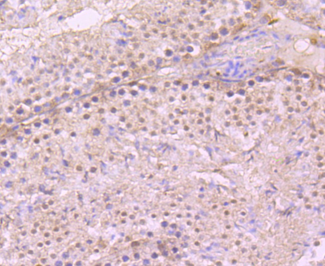 Immunohistochemical analysis of paraffin-embedded mouse testis tissue using anti- PARP1 antibody. Counter stained with hematoxylin.