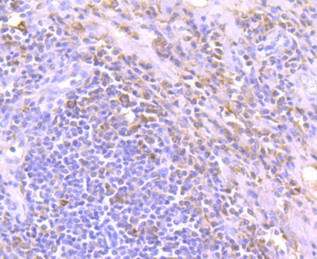 Immunohistochemical analysis of paraffin-embedded human tonsil tissue using anti-Tim3 antibody. Counter stained with hematoxylin.