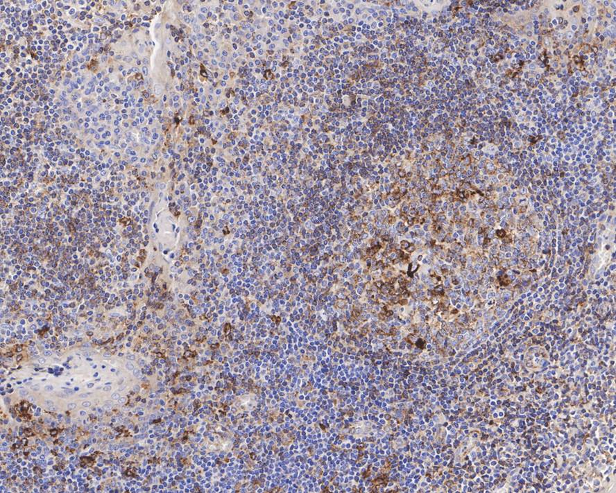 Immunohistochemical analysis of paraffin-embedded human spleen tissue using anti-Tim3 antibody. Counter stained with hematoxylin.