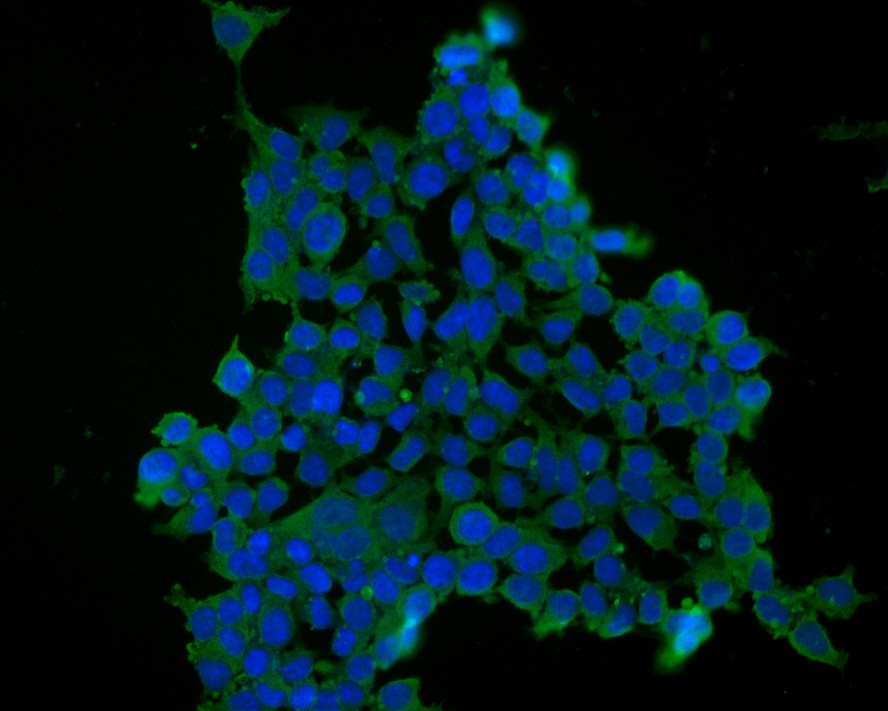 Immunohistochemical analysis of paraffin-embedded human tonsil tissue using anti-Tim3 antibody. Counter stained with hematoxylin.