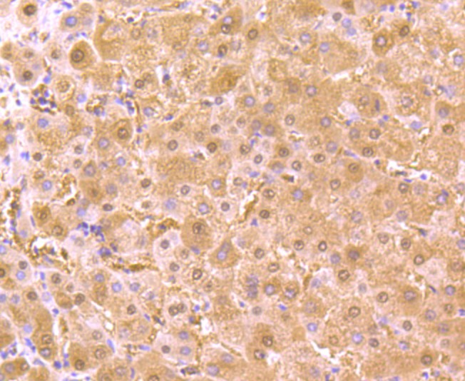Immunohistochemical analysis of paraffin-embedded human liver tissue using anti-AKR1C1 antibody. Counter stained with hematoxylin.