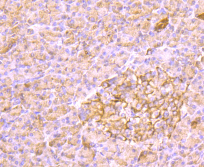 Immunohistochemical analysis of paraffin-embedded human pancreas tissue using anti-AKR1C1 antibody. Counter stained with hematoxylin.