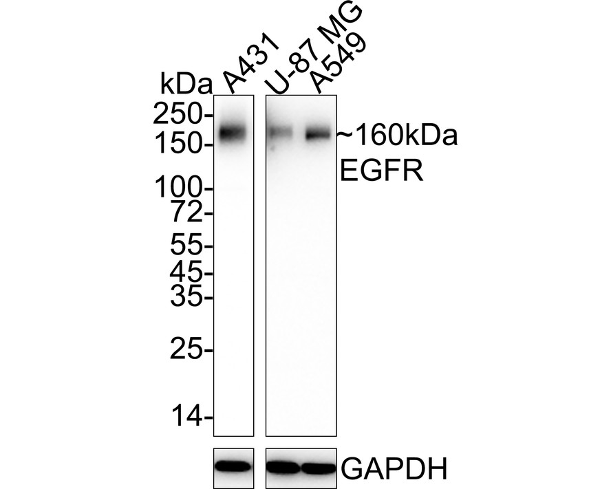 Western blot analysis of EGFR on different lysates with Mouse anti-EGFR antibody (EM1701-22) at 1/1,000 dilution.<br />
<br />
Lane 1: A431 cell lysate<br />
Lane 2: U-87 MG cell lysate<br />
Lane 3: A549 cell lysate<br />
<br />
Lysates/proteins at 20 µg/Lane.<br />
<br />
Predicted band size: 134 kDa<br />
Observed band size: 160 kDa<br />
<br />
Exposure time: Lane 1: 5 seconds; Lane 2-3: 43 seconds; ECL: K1801;<br />
<br />
4-20% SDS-PAGE gel.<br />
<br />
Proteins were transferred to a PVDF membrane and blocked with 5% NFDM/TBST for 1 hour at room temperature. The primary antibody (EM1701-22) at 1/1,000 dilution was used in 5% NFDM/TBST at 4℃ overnight. Goat Anti-Mouse IgG - HRP Secondary Antibody (HA1006) at 1/50,000 dilution was used for 1 hour at room temperature.
