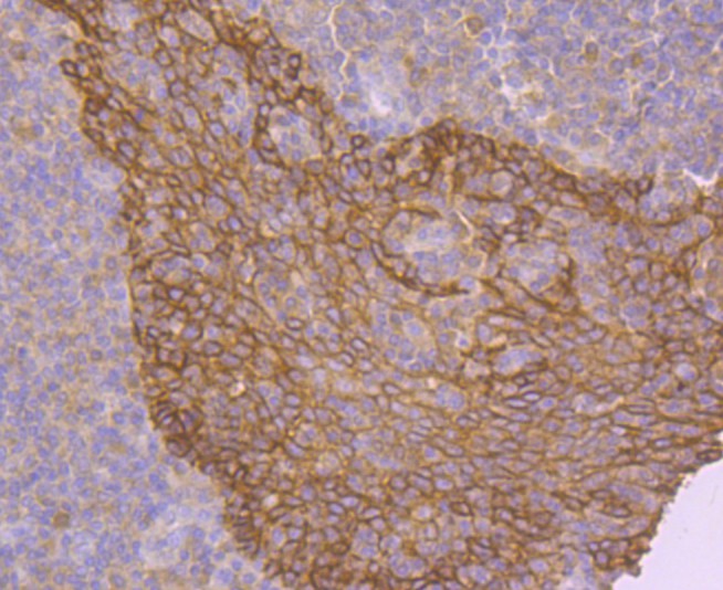 Immunohistochemical analysis of paraffin-embedded human tonsil tissue using anti-EGFR antibody. Counter stained with hematoxylin.