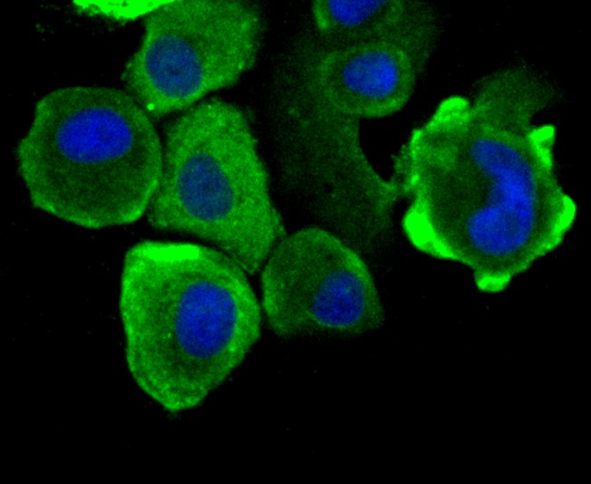 ICC staining Grp75 (green) in SK-Br-3 cells. The nuclear counter stain is DAPI (blue). Cells were fixed in paraformaldehyde, permeabilised with 0.25% Triton X100/PBS.
