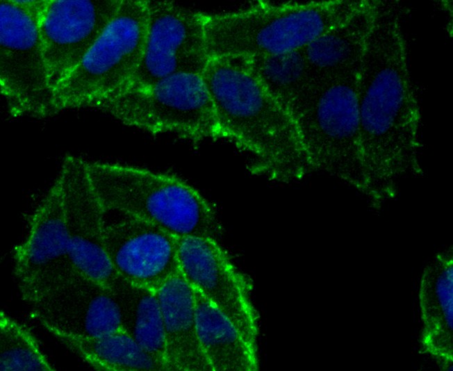 ICC staining CD134 (green) in HepG2 cells. The nuclear counter stain is DAPI (blue). Cells were fixed in paraformaldehyde, permeabilised with 0.25% Triton X100/PBS.