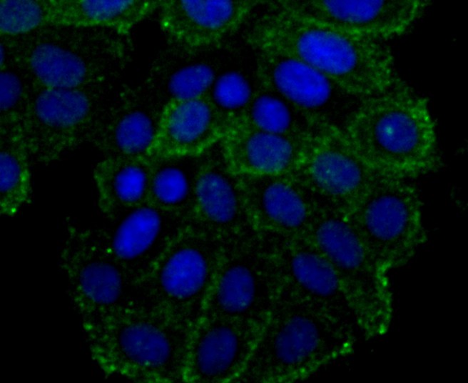 ICC staining CD134 (green) in HepG2 cells. The nuclear counter stain is DAPI (blue). Cells were fixed in paraformaldehyde, permeabilised with 0.25% Triton X100/PBS.