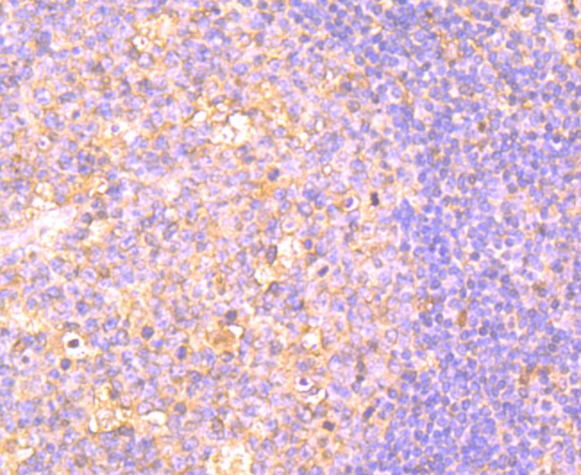 Immunohistochemical analysis of paraffin-embedded human spleen tissue using anti-CD134 antibody. Counter stained with hematoxylin.