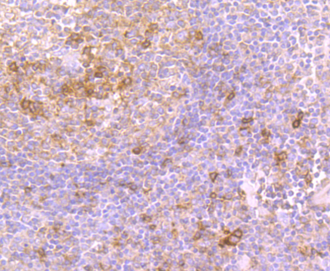 Immunohistochemical analysis of paraffin-embedded human tonsil tissue using anti-CD134 antibody. Counter stained with hematoxylin.