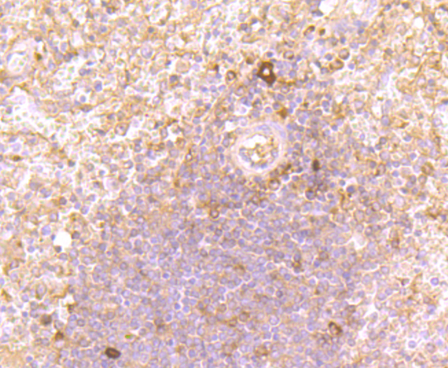 Immunohistochemical analysis of paraffin-embedded human spleen tissue using anti-CD134 antibody. Counter stained with hematoxylin.