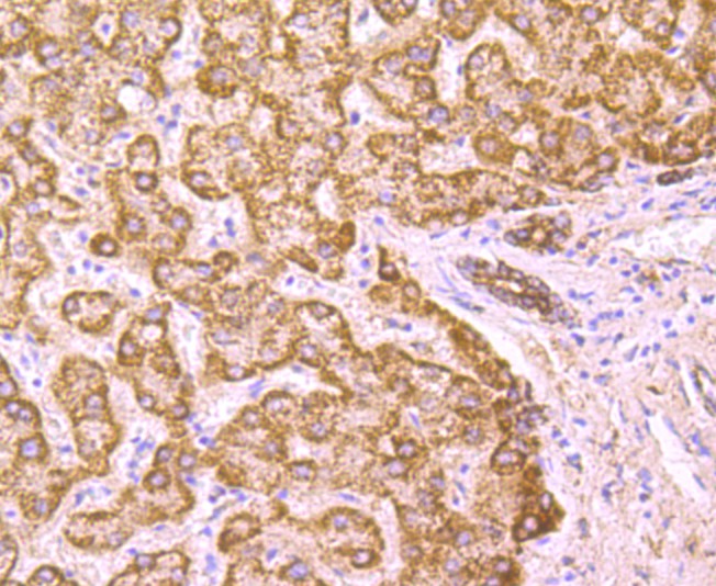 ICC staining PCSK9 (green) in PANC-1 cells. The nuclear counter stain is DAPI (blue). Cells were fixed in paraformaldehyde, permeabilised with 0.25% Triton X100/PBS.