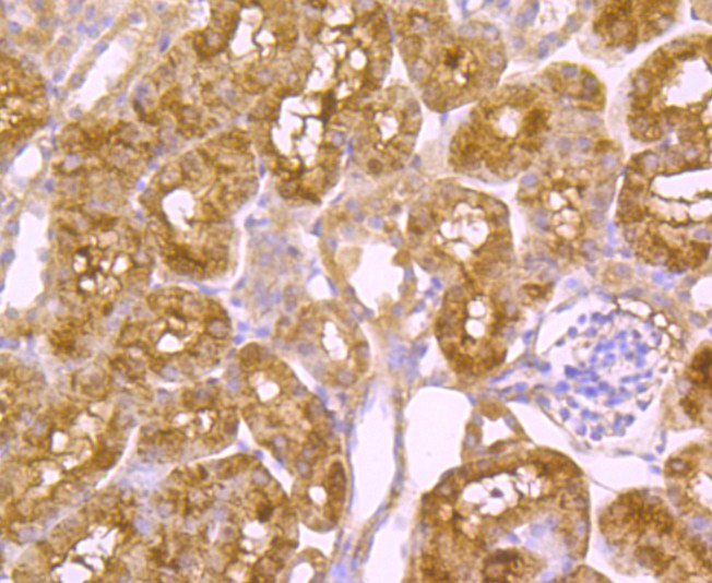 Immunohistochemical analysis of paraffin-embedded human kidney tissue using anti-PCSK9 antibody. Counter stained with hematoxylin.