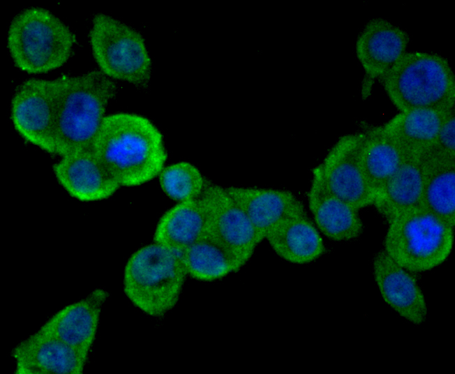 ICC staining PCSK9 (green) in LOVO cells. The nuclear counter stain is DAPI (blue). Cells were fixed in paraformaldehyde, permeabilised with 0.25% Triton X100/PBS.